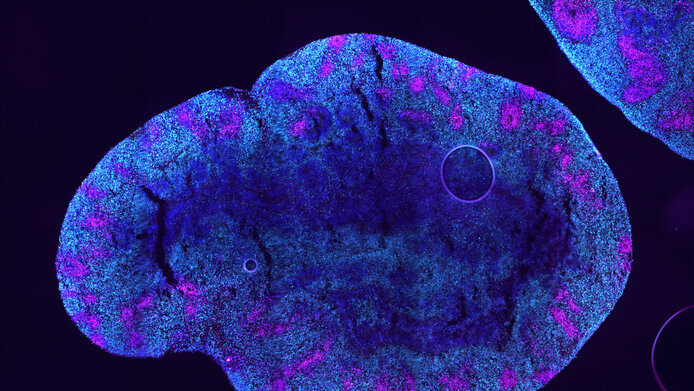 mini-brain: two-millimeter specimen under the fluorescence microscope