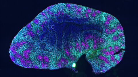 Zerebrale Organoid (Mini-Hirn): zwei Millimeter kleines Exemplar unter dem Fluoreszenzmikroskop