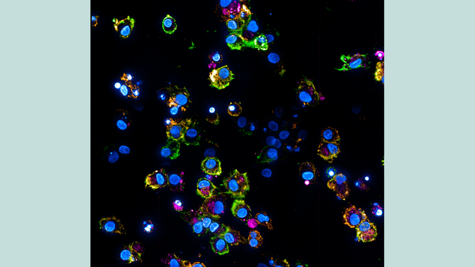 Mikroskopische Aufnahme von dendritischen Zellen, die mit HIV-Partikeln infiziert wurden