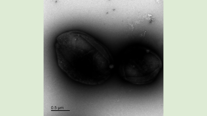 Den Stoff für die neuen Technologien liefert ein winziger Ureinwohner und Überlebenskünstler: der Sulfolobus acidocaldarius. Hier sieht man Zellen dieses Mikroorganismus unter dem Mikroskop.