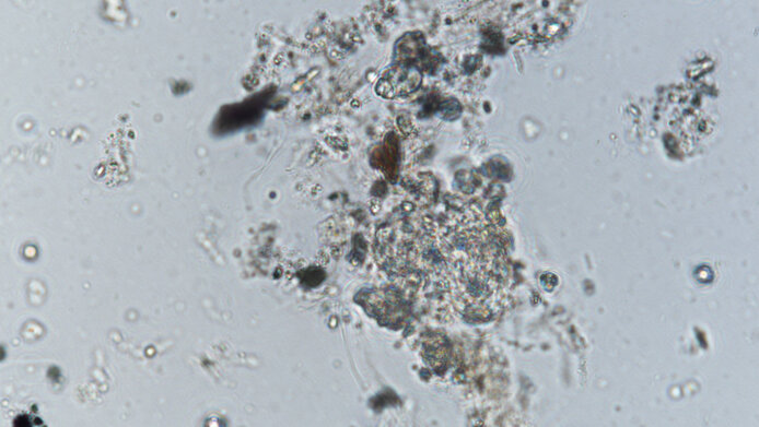 Mikroorganismen unter dem Mikroskop