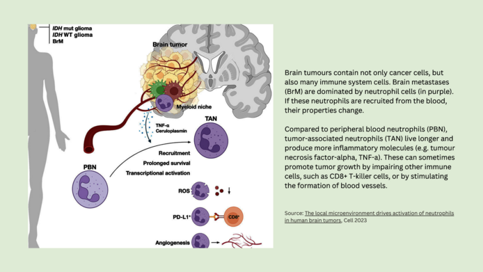Development of brain metastases