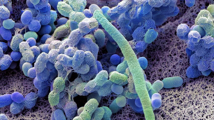 Scanning electron micrograph from a culture of a four day old baby stool.
