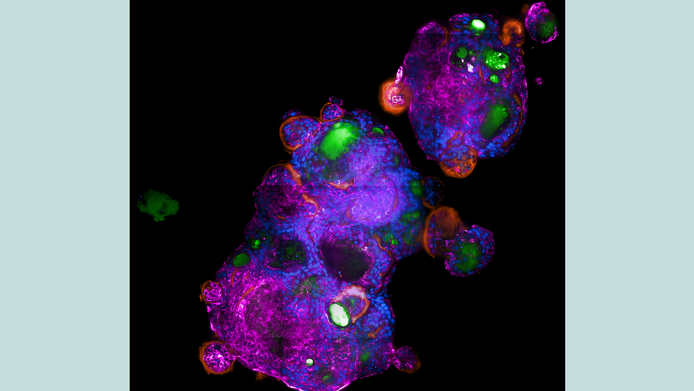 Ein Lungen-Organoid in mikroskopischer Auflösung zeigt die Interaktion mit dem Coronavirus