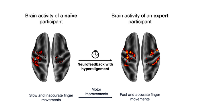Magnetresonanzaufnahme von zwei Gehirnen im Vergleich: Amateur und Experte