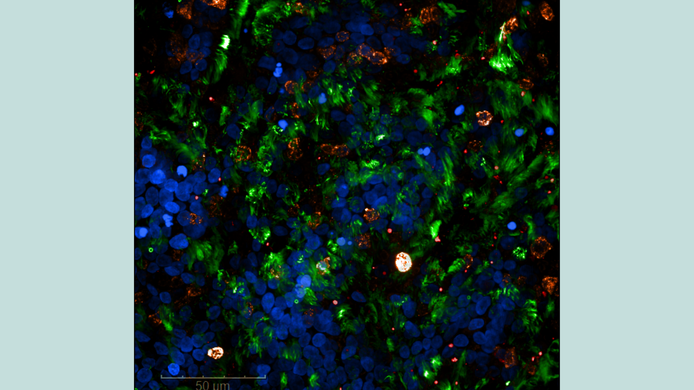 Zellaufnahme der oberen Atemwege, die mit dem Coronavirus infiziert sind