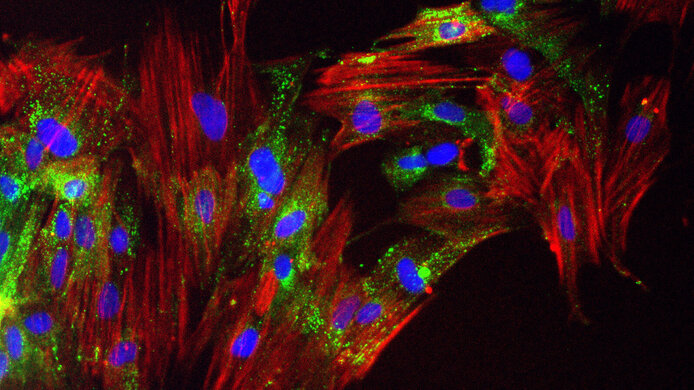 Microscopic images of a culture of cancer-associated fibroblasts from the biobank. On the right, cancer-associated fibroblasts in the late activation stage were marked with fluorescent substances (green: cell interior, blue: cell nuclei, red: parts of the cytoskeleton). 