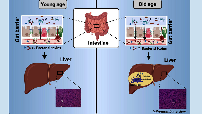Grafisches Abstract einer jungen und alternden Leber im Vergleich - durch den Austritt entzündlicher Bakterien durch die Darmwand