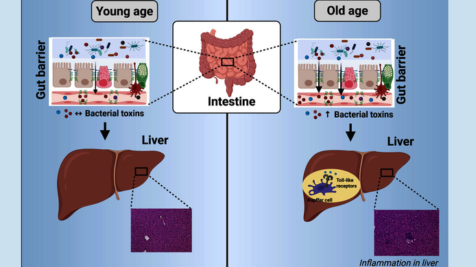 Graphic abstract comparing a young and aging liver – due to the escape of inflammatory bacteria through the intestinal wall